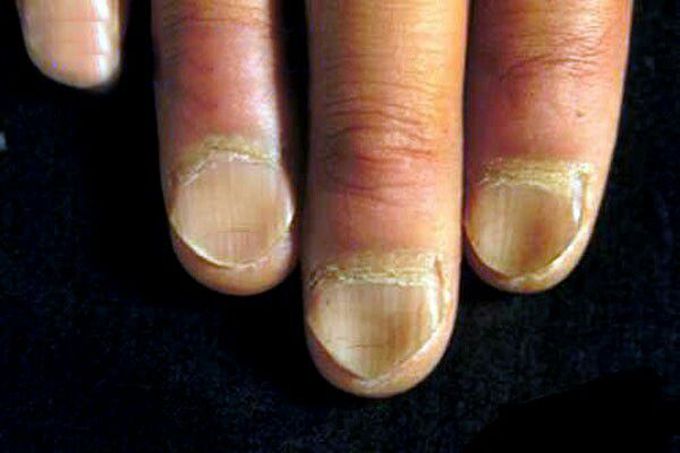 What's your diagnosis??? In what cases do we see it??