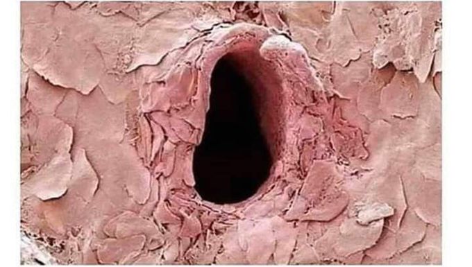 Hole , which a syringe 💉 left in our body