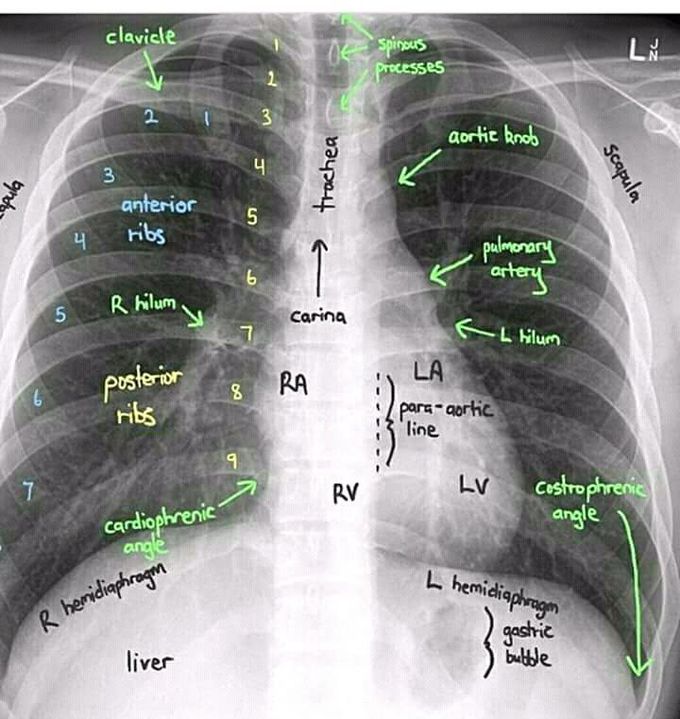 Thorax