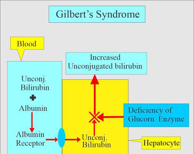 Gilberts syndrome MEDizzy