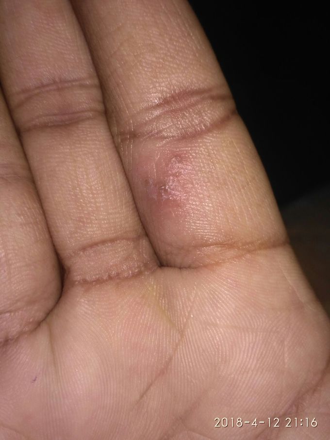 Dermatology