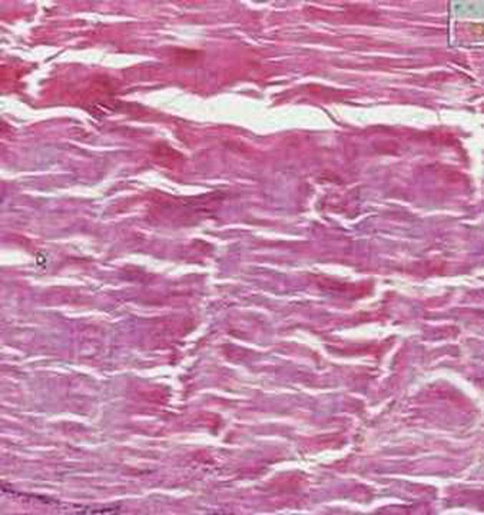 Dense Connective Tissue Histology