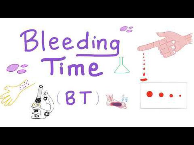 Test for hemostasis: basics, bleeding time