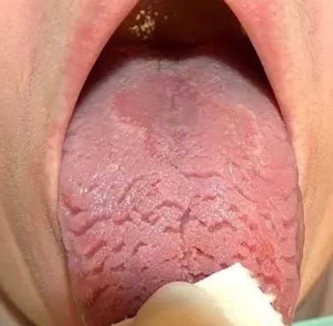 ??what is your diagnosis