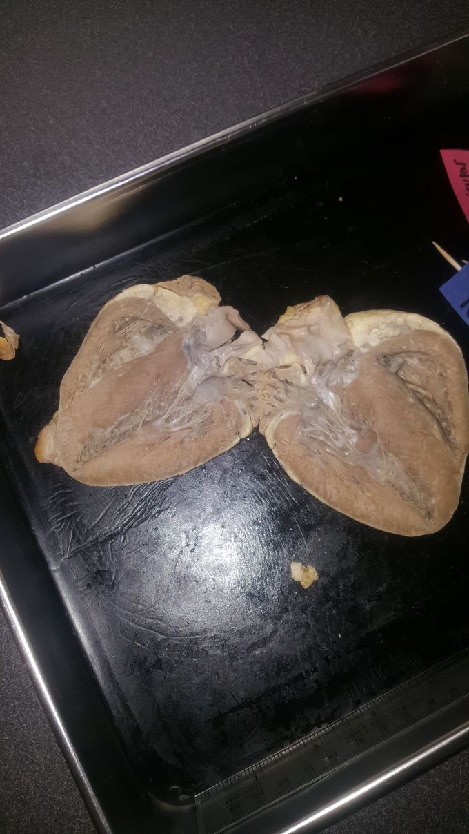 Inside of sheep's heart (dissection) 