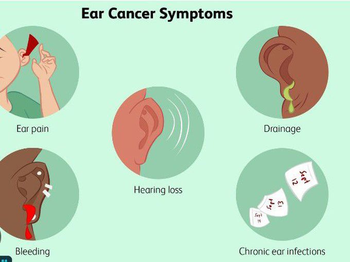 Symptoms of Ear tumor