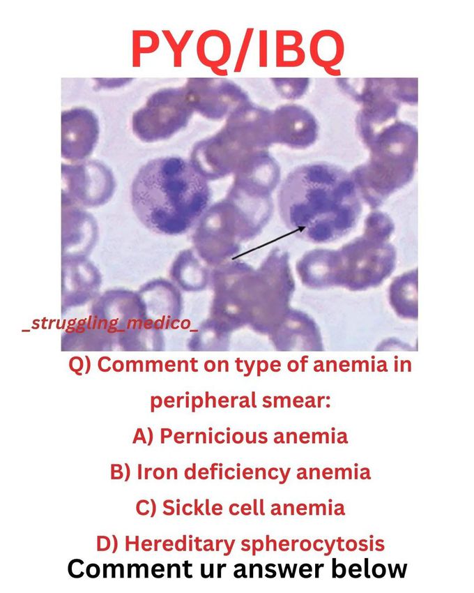 Type of Anemia