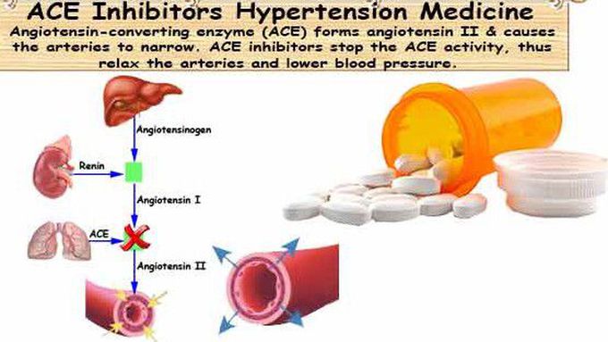 ACE Inhibitors Linked to Higher Lung Cancer Risk