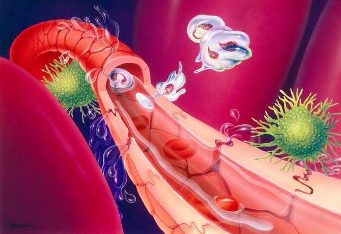 Septic shock