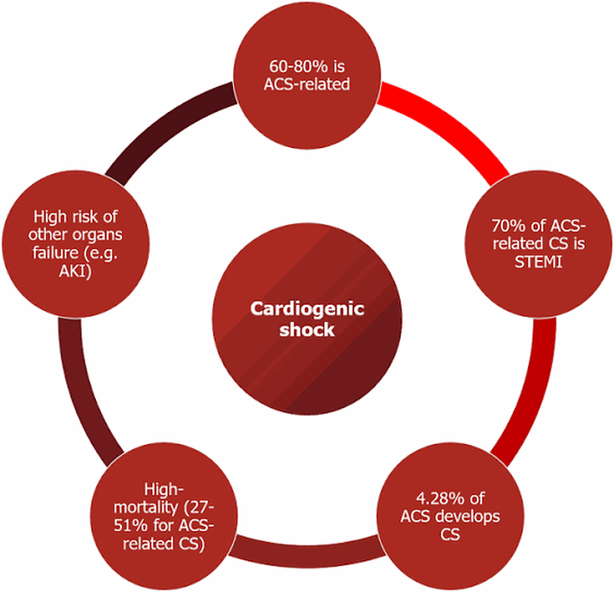 Causes of cardiogenic shock