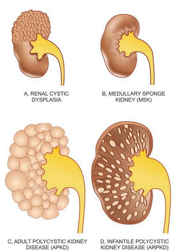 Renal pathology