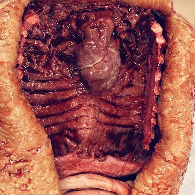 Interior of an autopsy