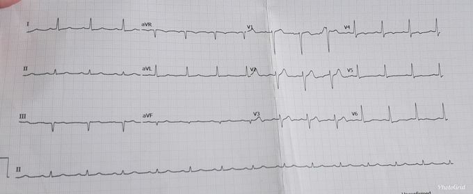 Diagnosis?