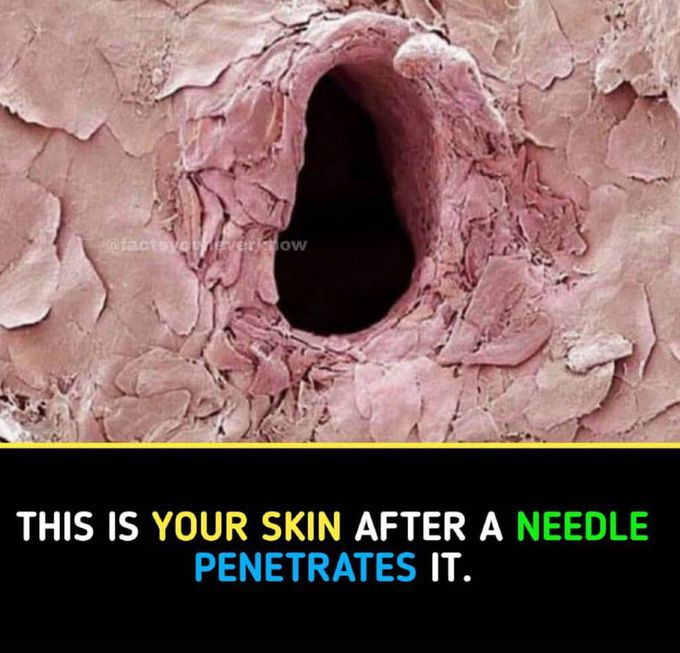 Microscopic view after needle penetrated in skin