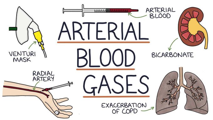 Arterial Blood Gases