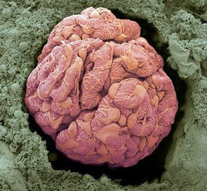 Kidney glomerus
