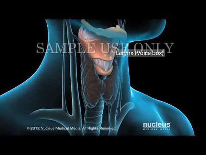Robotic Thyroidectomy-Animation
