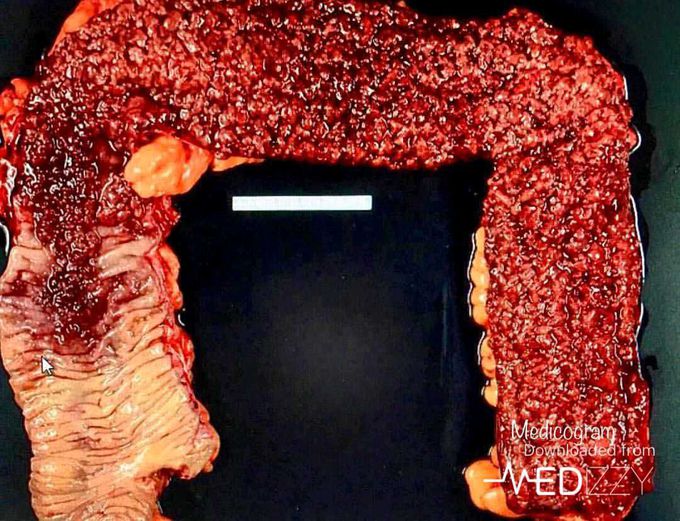 What is the diagnosis?