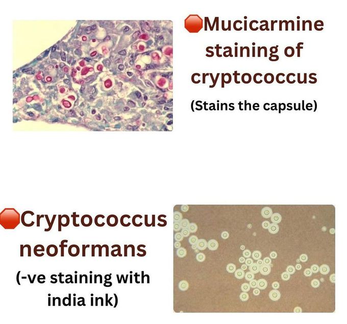 Mycology Review