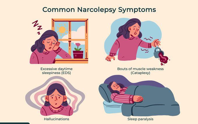 Symptoms of Narcolepsy