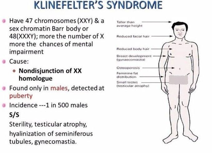 Klinefelter's Syndrome