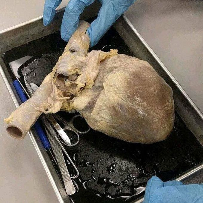 about to slice open this fatty pig heart 🐽