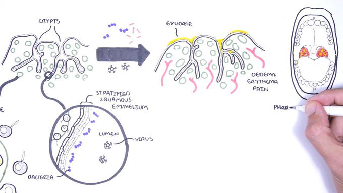 Clinical anatomy of the Tonsils