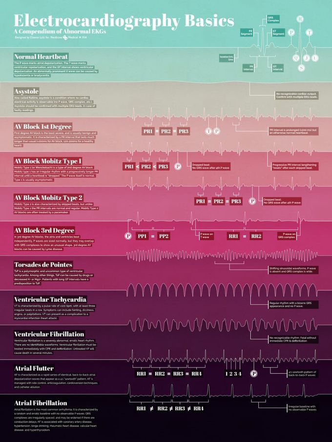Basics of electrocardiograph