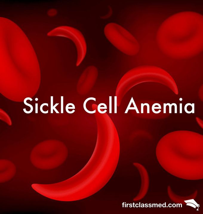 Sickle Cell Anemia - From African Myth to Modern Therapy