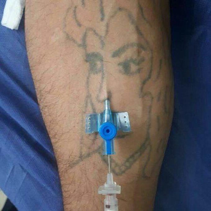 Gaze of blue cannula...?