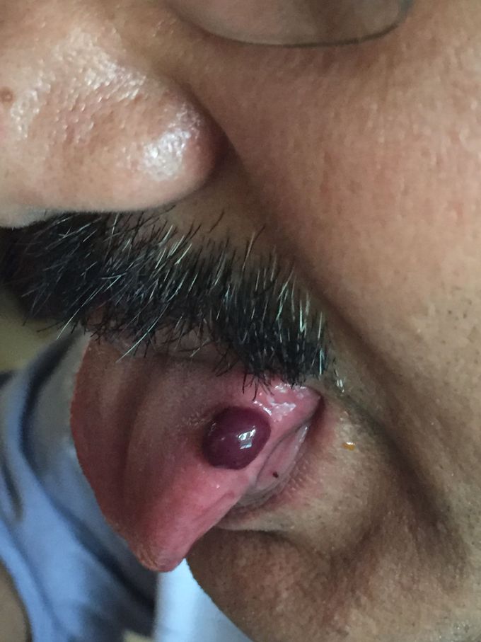 What is this can anybody tell me suddenly happened while eating