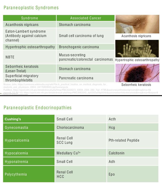 Carcinogenesis