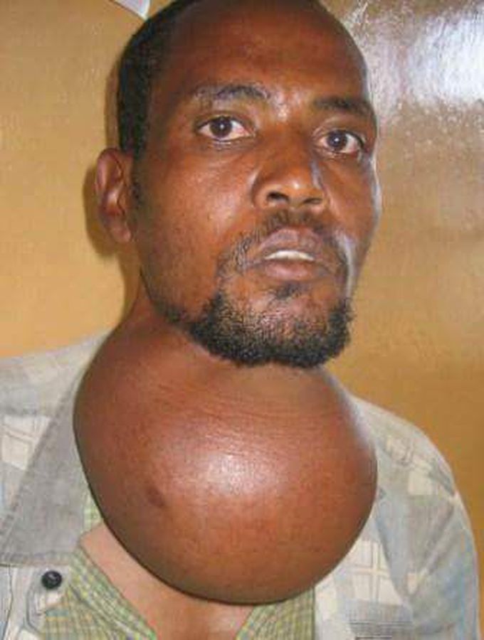 Diagnosis ?