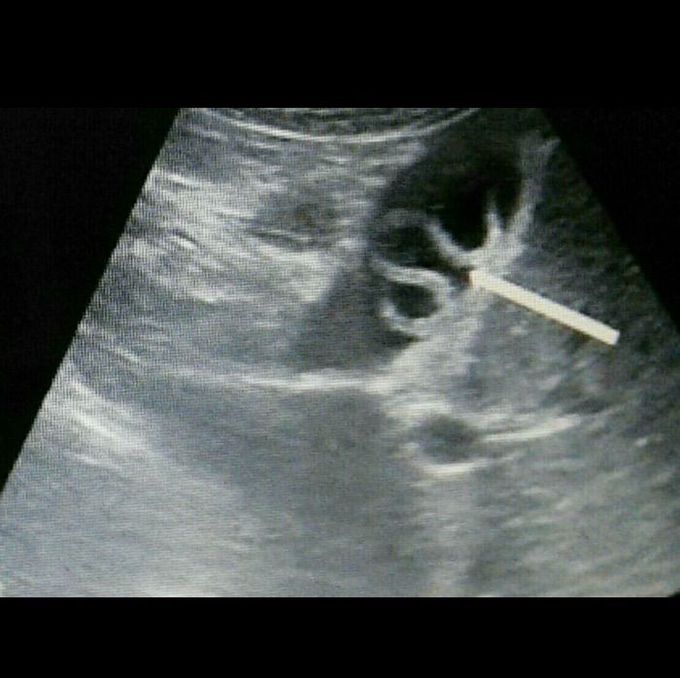 What is your diagnosis?