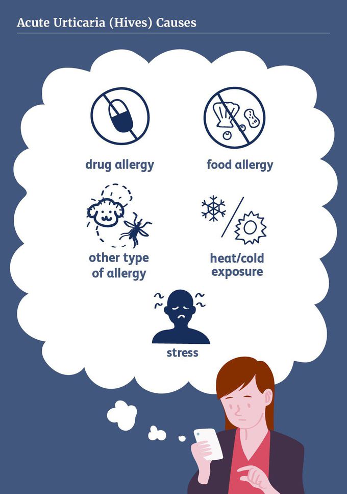 Causes of hives