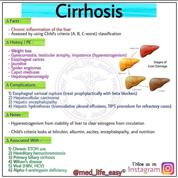 Liver cirrhosis