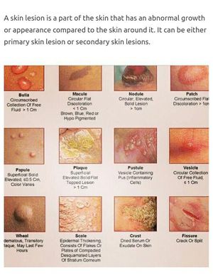 Skin lesions - MEDizzy