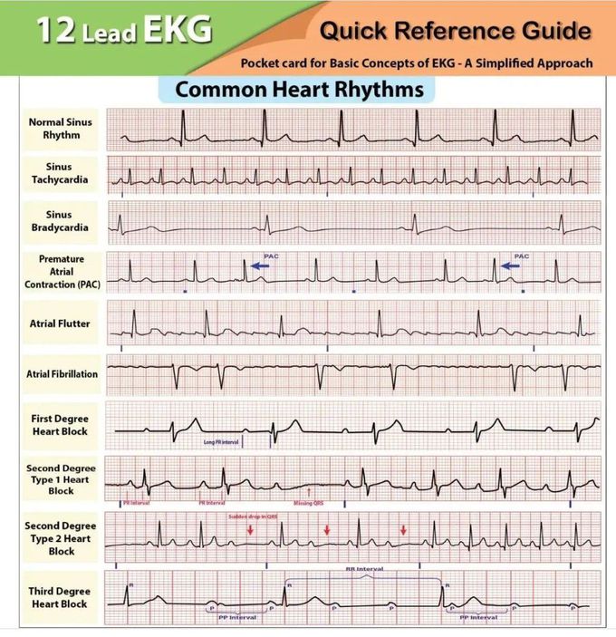 12 Lead EKG