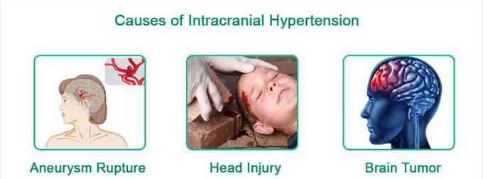 These are the causes of Intracranial hypertension syndrome