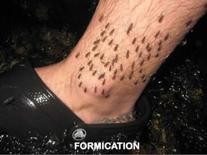 Tactile hallucinations and Formication: Strange skin sensations including  insects crawling on your skin – Caring Medical Florida