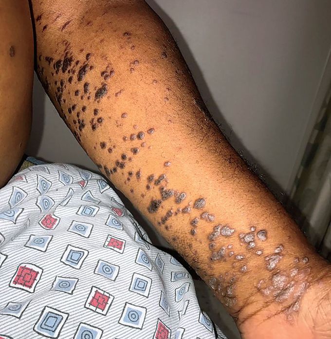 What is your diagnosis???