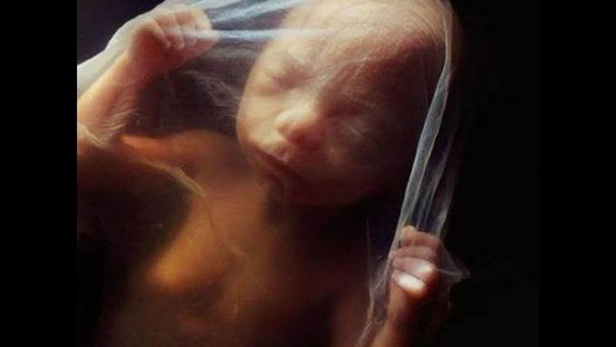 Incredible Real Photography of the journey from a sperm to human baby- Developing in the womb