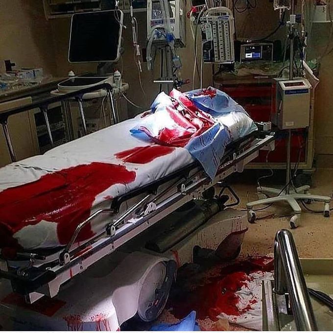 Which speciality needed for this casualties?