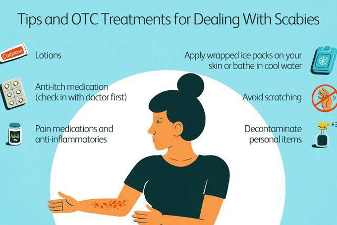 Treatment of scabies.