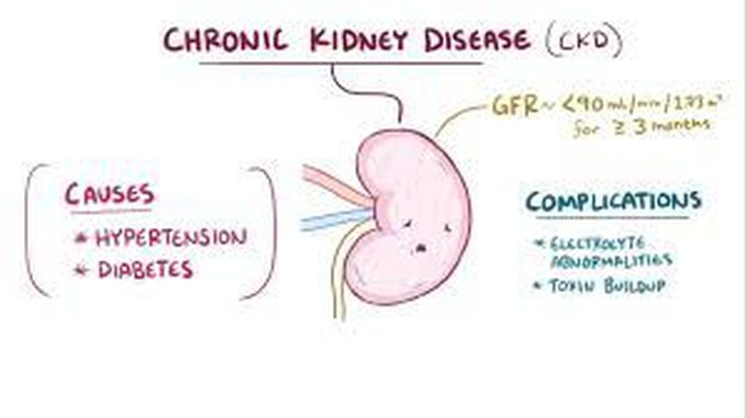 Symptoms of Chronic kidney disease