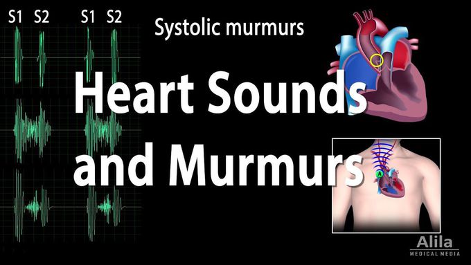Heart sounds