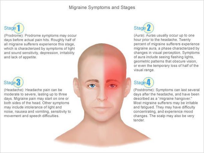Migraine headache