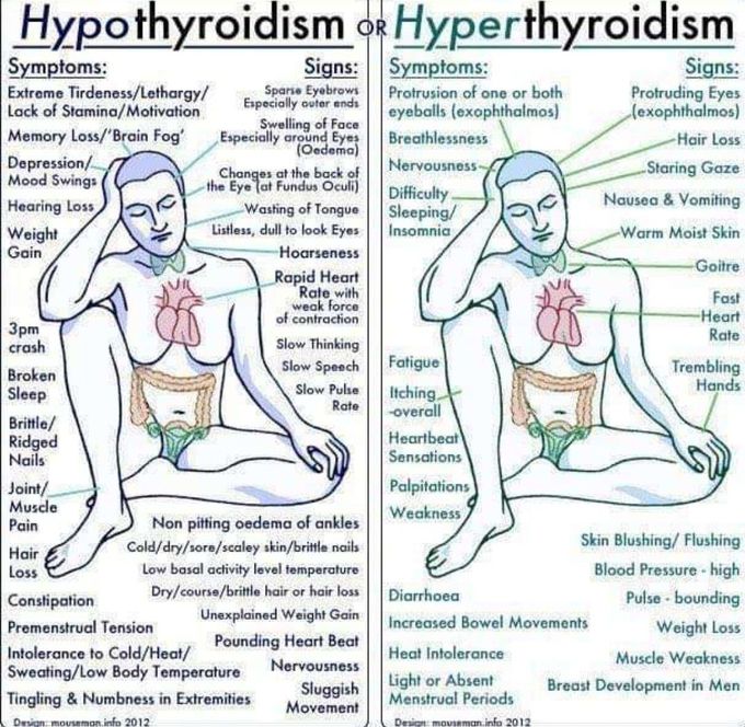 Hypothyroidism vs hyperthyroidism