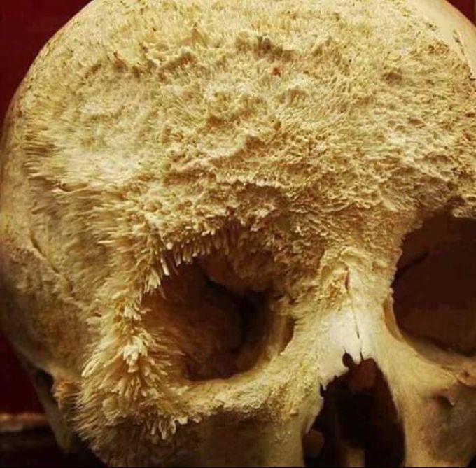 Bone🤍