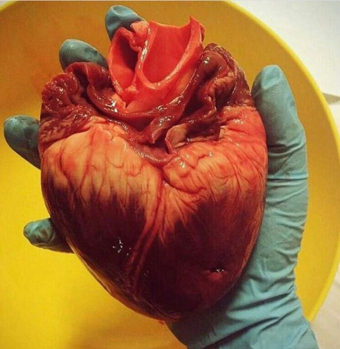 Heart